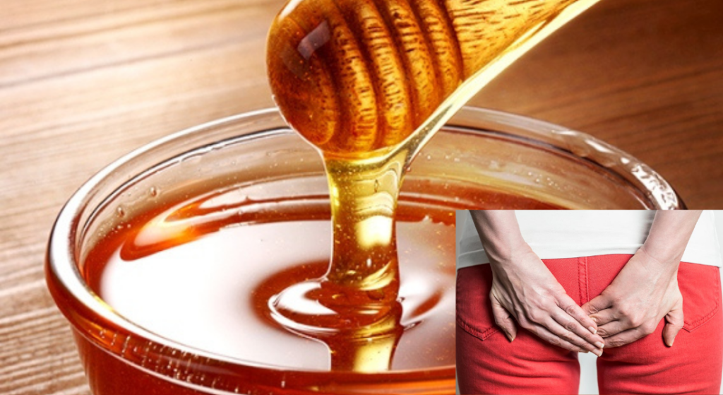 Comment traiter les hémorroïdes avec du miel ?