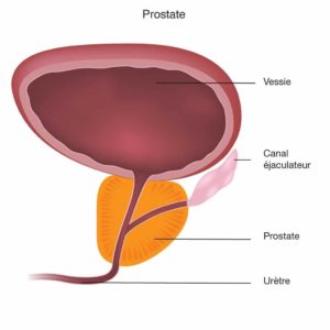 Pharmacopée N025 : traitement naturel de la prostate par les plantes